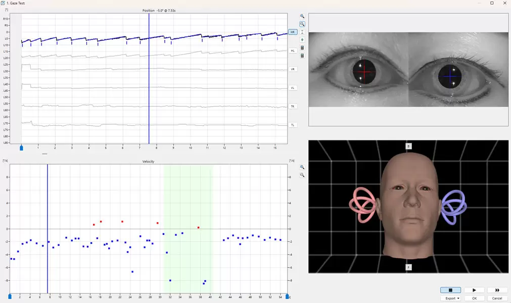 Smart Review & Interconnected Workflow